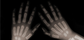 Building Better Bones